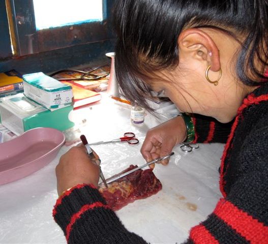 Tenzing suturing